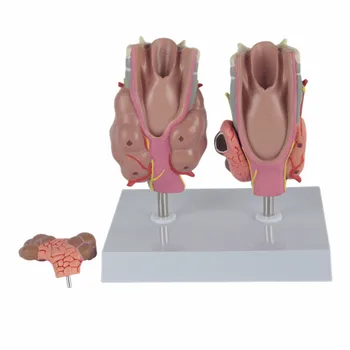 Модел на патология на щитовидната жлеза анатомия на гърлото модел на заболяване на щитовидната жлеза